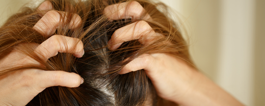 woman scratches her itchy scalp