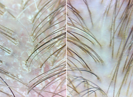 before and after using the scrub