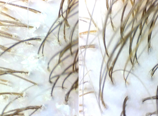 Before and after using scrub