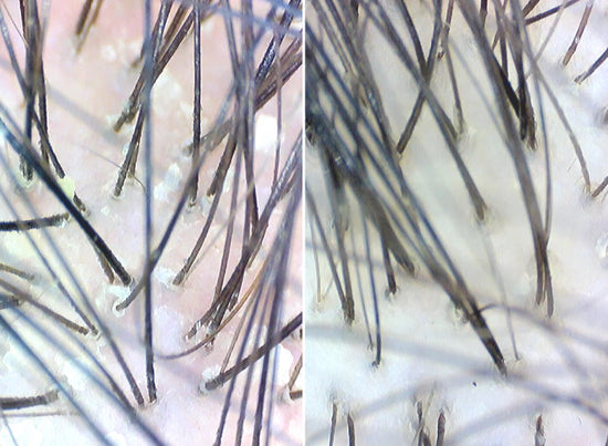 before and after using the scrub