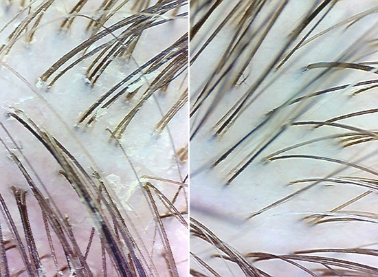 before and after using the scrub