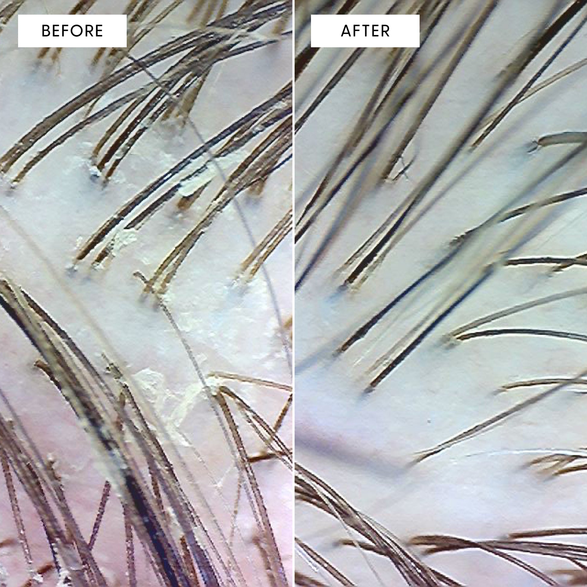 Before and after scalp close up with scrub