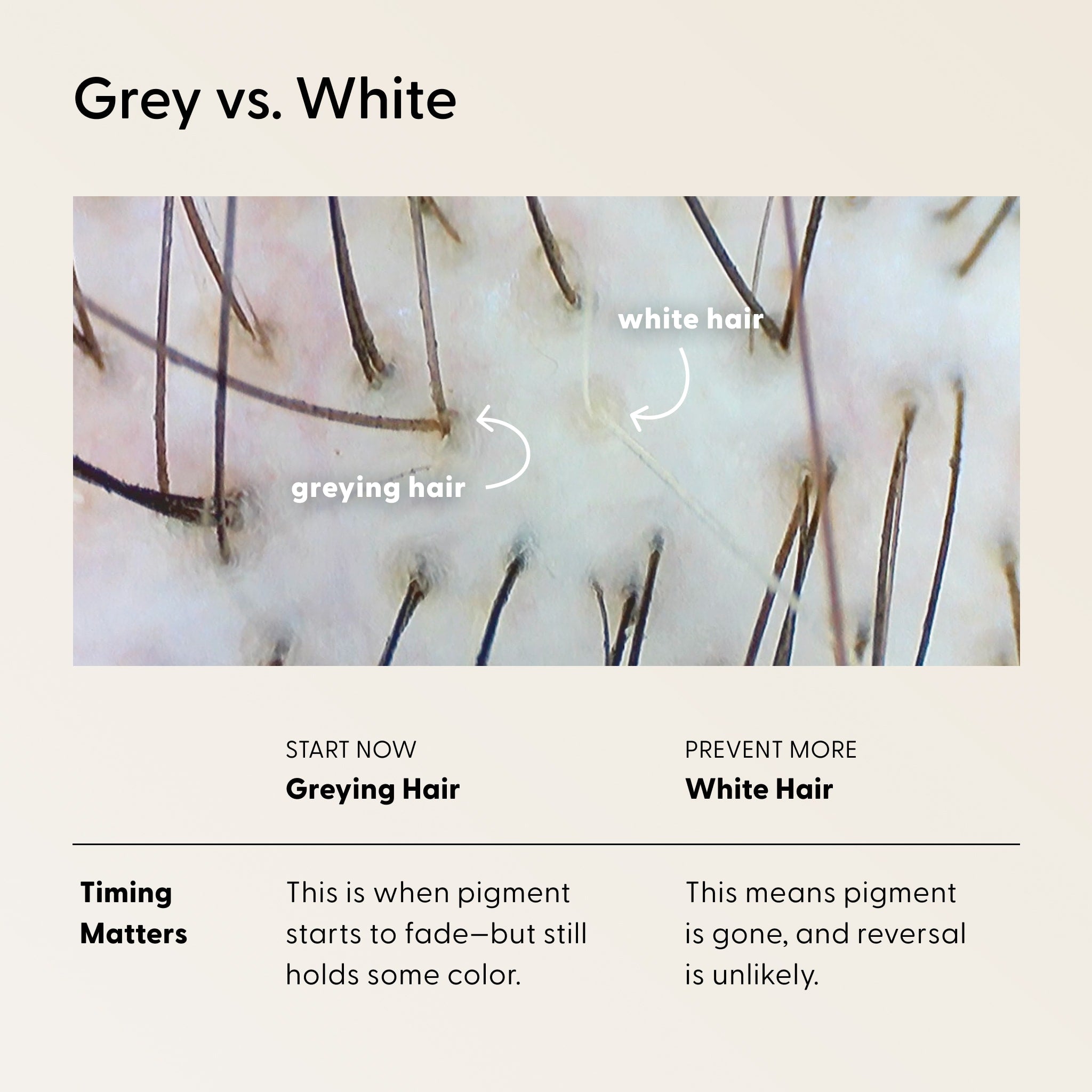 Close-up of scalp showing gray and white hairs. Diagram labels each hair type. Below, a chart explains that greying hair can fade and may be reversible, while white hair means lost pigment and reversal is unlikely. Incorporating The Shower Duo by Arey—an in-shower hair care system designed to cleanse and restore—may support healthier hair as you address changes in pigment.