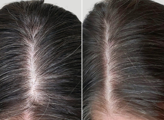 before and after using the shower duo