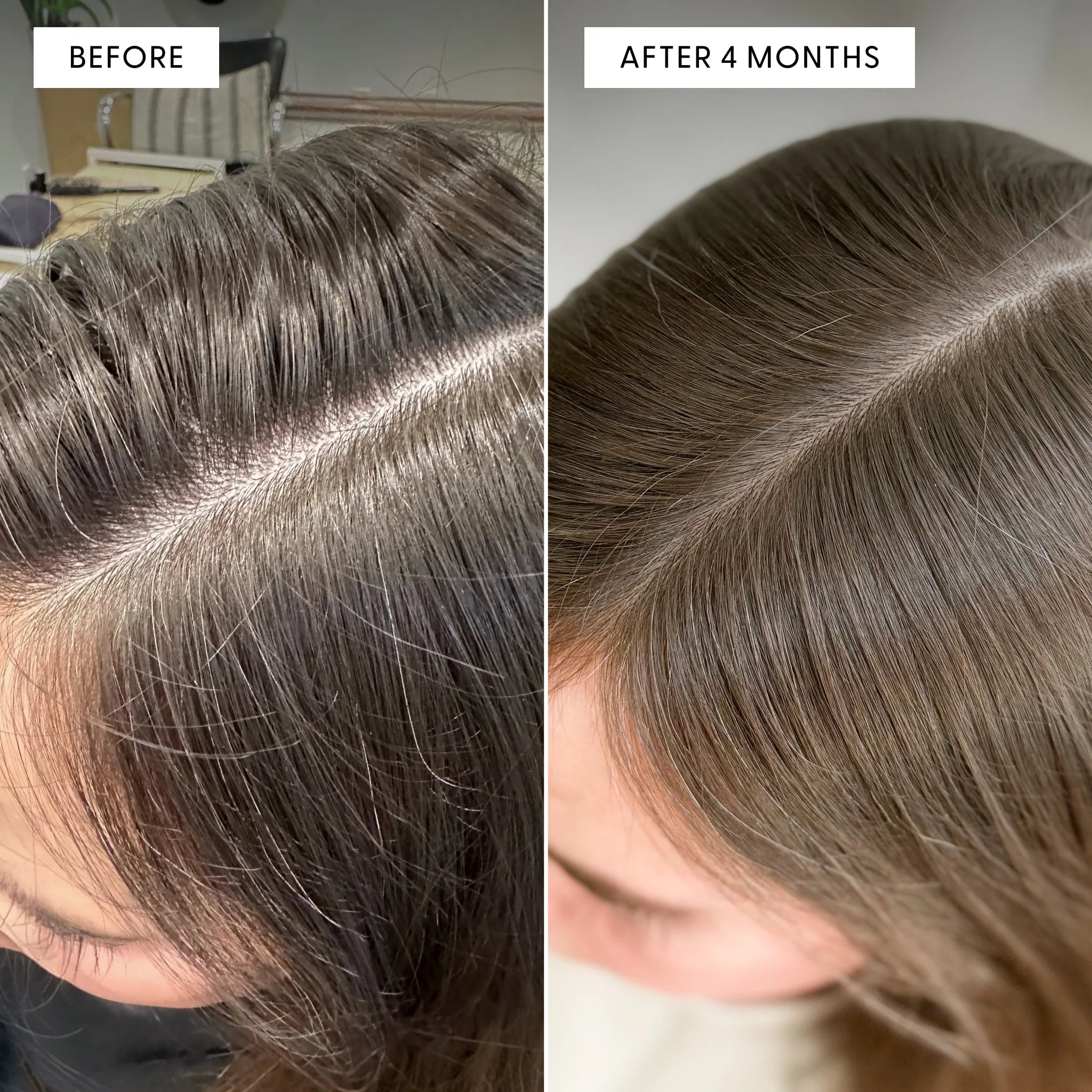 Arey's patented formulas slow greys, support scalp health, and promote thicker, fuller hair.