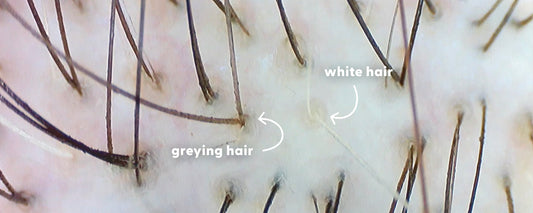 Grey vs. White Hair