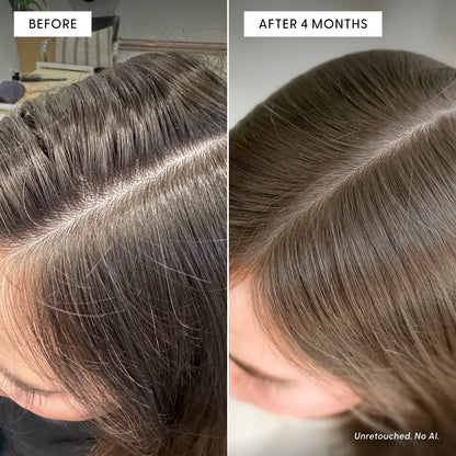Split image of a woman’s scalp shows “Before” with visible thinning hair and “After 4 Months” with noticeably thicker, fuller hair and less visible scalp. Text notes the photo is unretouched with no AI used, showcasing the transformative results of consistent hair wellness rituals like using Arey’s The Beauty Sleep Duo overnight for optimal growth support.