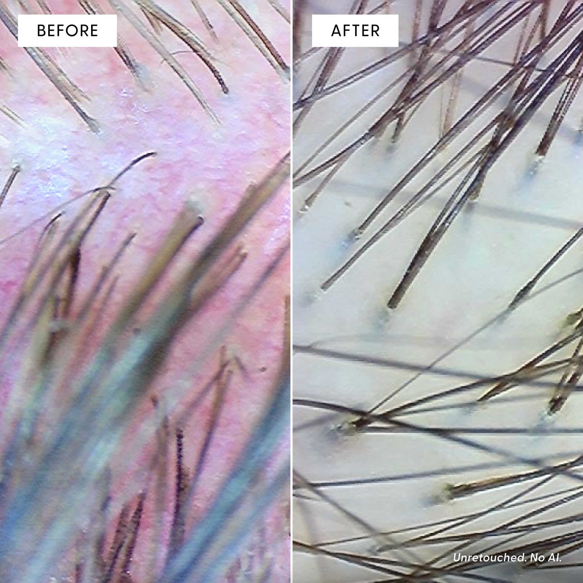 Split close-up image of a scalp: on the left, red and irritated skin with sparse hair (before), illustrating oxidative stress before use of Calm It Down Scalp Serum by Arey; on the right, smoother, calmer skin with visibly thicker hair growth (after), highlighting enhanced scalp protection after using the serum. Each section is labeled at the top.