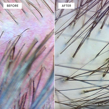 Split close-up image of a scalp: on the left, red and irritated skin with sparse hair (before), illustrating oxidative stress before use of Calm It Down Scalp Serum by Arey; on the right, smoother, calmer skin with visibly thicker hair growth (after), highlighting enhanced scalp protection after using the serum. Each section is labeled at the top.