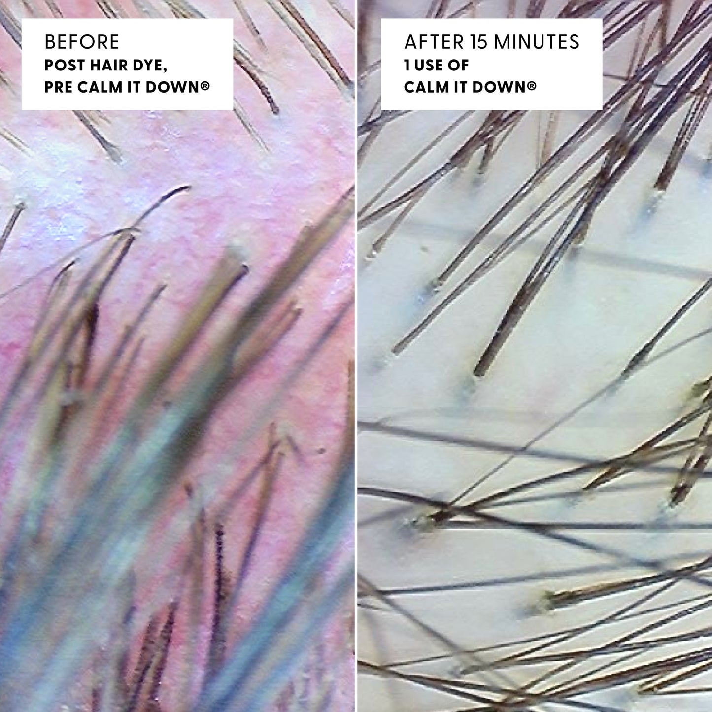 Close up image of a scalp before and after using Calm It Down. Before is red and irritated, after is healthy and clean.