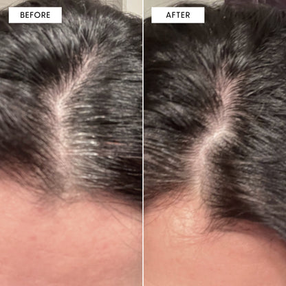 Before and after image using the full arey