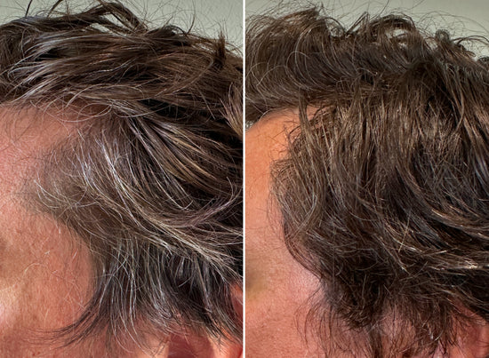 Side-by-side close-up photos of a persons hair: the left side shows gray strands, while the right side shows the same hair with a darker, more uniform color and minimal gray.