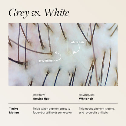 scalp photo comparing greying hair—some pigment remains—and white hair—pigment gone; message: start during greying for best chance of improvement.