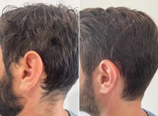 before and after image of using Live In Mist