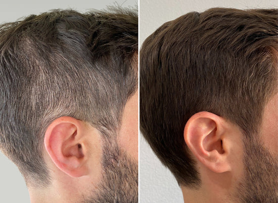 before and after using not today grey