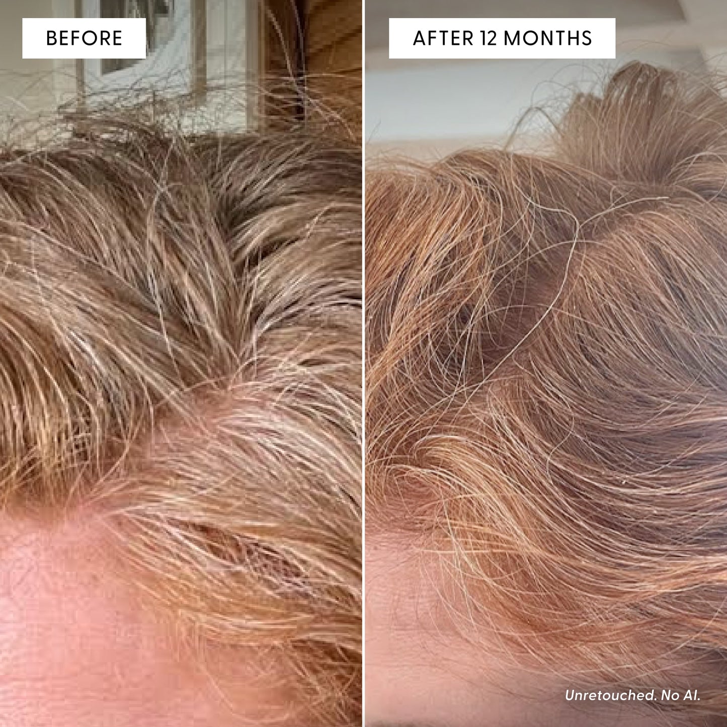 Side-by-side close-up of a person’s scalp and hair: left shows graying hair before, right—after 12 months of using Arey Not Today, Grey™—reveals thicker hair with fuller, more vibrant red-toned strands and visible repigmentation. Text notes Unretouched. No AI.
