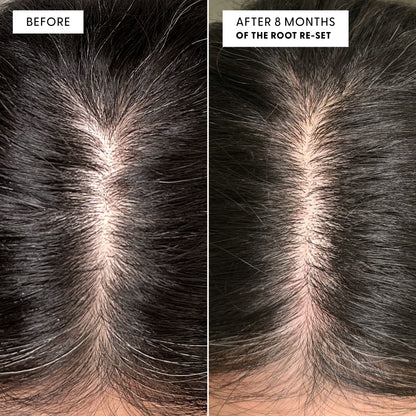 Before and after image of a customer using The Root Re-Set for 8 months. Appearance of greys looks visibly improved.