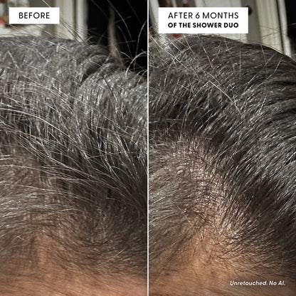 Close-up split image of a scalp, showing more hair density before and visibly thinning hair after 6 months of using The Inside-Out Set by Arey. Text notes that the images are unretouched and not AI-generated, highlighting the product’s impact on hair health and pigment preservation.