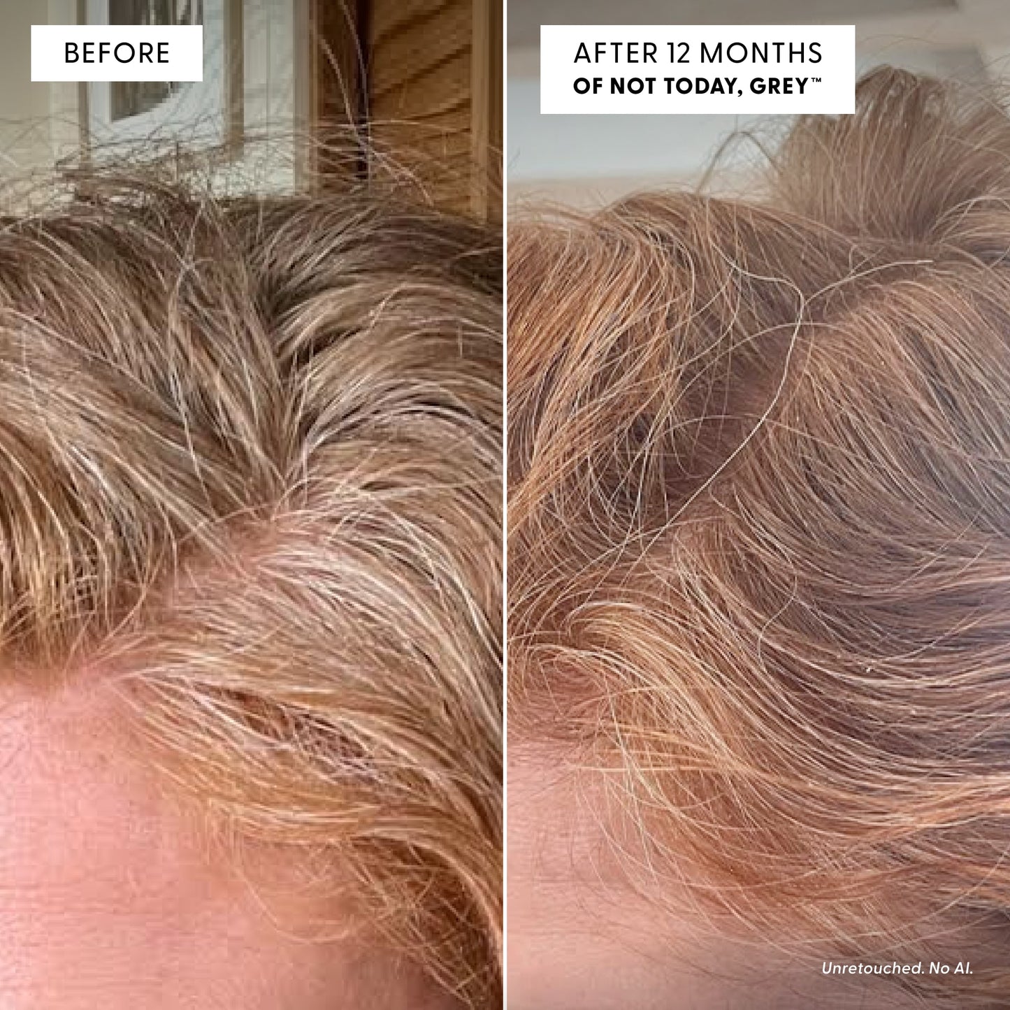 Side-by-side close-ups of hair: the left displays more visible grey strands, while the right, labeled After 12 months of Arey’s The Inside-Out Set, reveals improved pigment retention and a more uniform hair color—demonstrating the benefits of this advanced grey hair supplement.