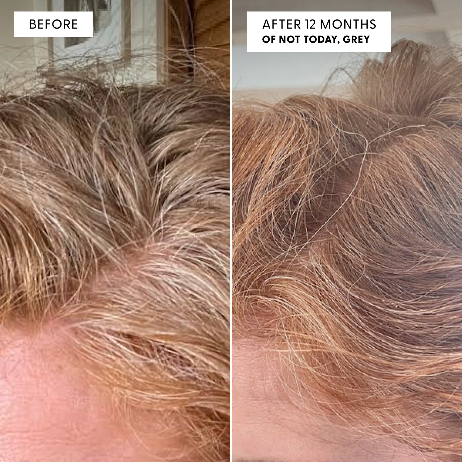 Before and after close-up photo showing grey hair reduction. Left panel labeled "BEFORE" shows heavily grey hair at the crown. Right panel labeled "AFTER 12 MONTHS OF NOT TODAY, GREY" shows the same area with noticeably reduced grey and warmer pigmented hair tones visible.