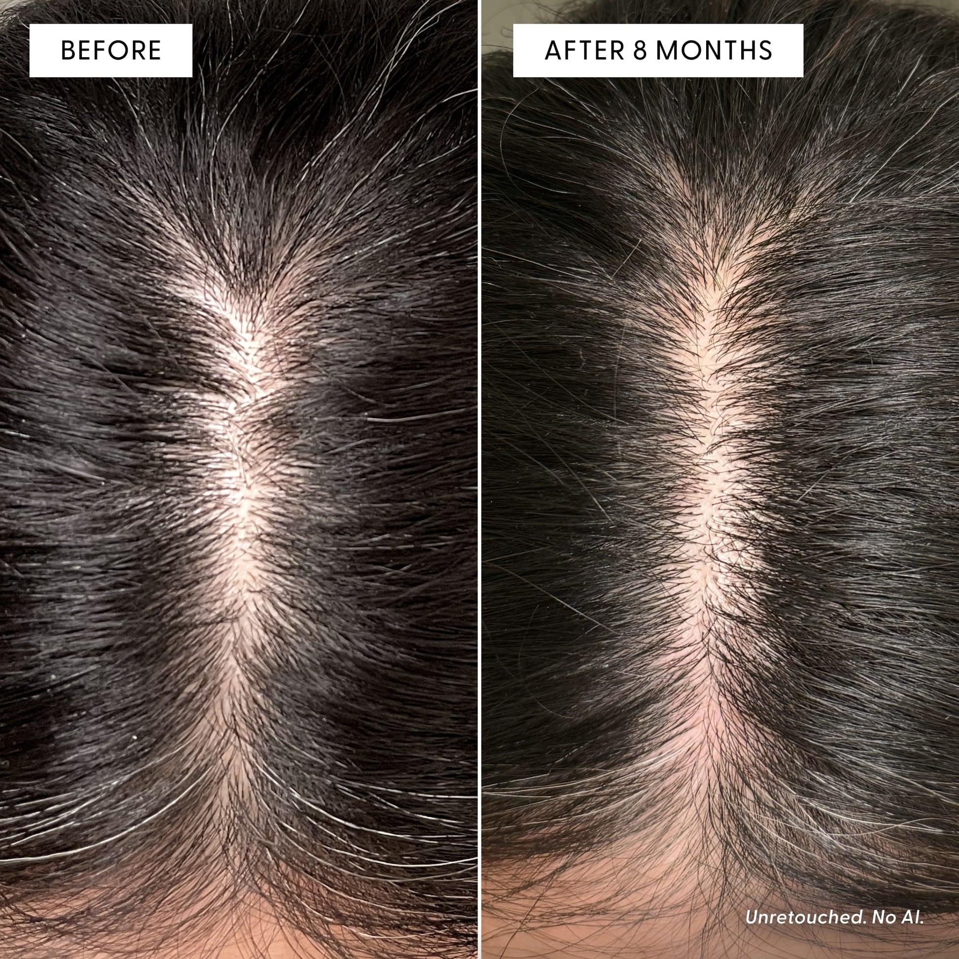 Side-by-side images show a person’s scalp before and after 8 months of using Arey The Root Re-Set. The “before” image reveals visible thinning hair, while the “after” shows noticeably thicker, fuller hair along the part, highlighting improved scalp health. Text states Unretouched. No AI.