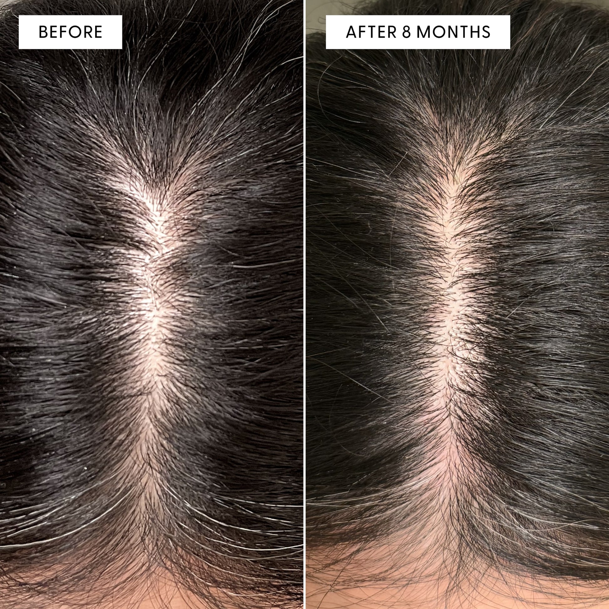 Before and after overhead view of a customer's scalp showing reduction in grey hairs after using Arey Root-Re-Set. Left labeled BEFORE shows grey at part line. Right labeled AFTER 8 MONTHS shows significantly darker, less grey hair.