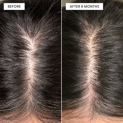 Before and after overhead view of a customer's scalp showing reduction in grey hairs after using Arey Root-Re-Set. Left labeled BEFORE shows grey at part line. Right labeled AFTER 8 MONTHS shows significantly darker, less grey hair.