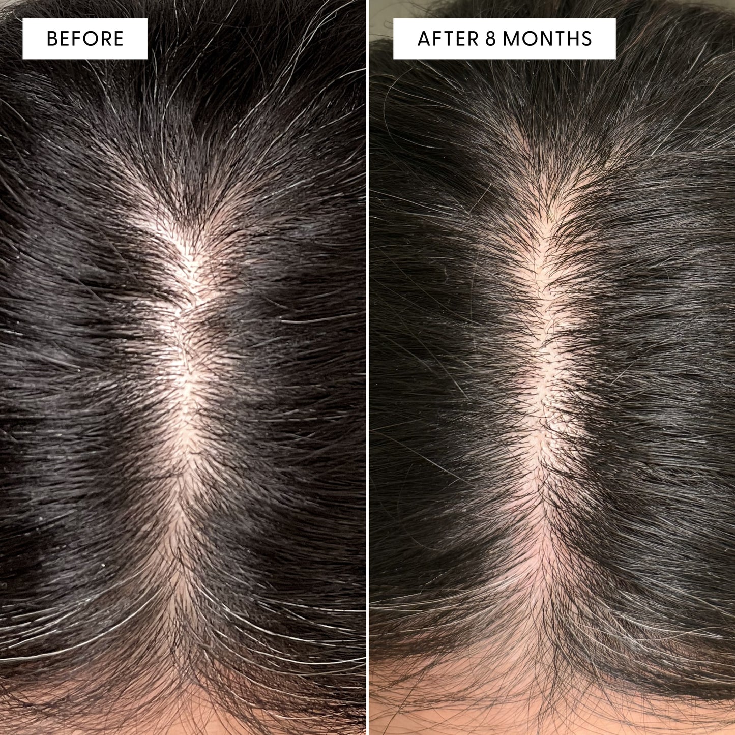 Before and after overhead view of a customer's scalp showing reduction in grey hairs after using Arey Root-Re-Set. Left labeled BEFORE shows grey at part line. Right labeled AFTER 8 MONTHS shows significantly darker, less grey hair.