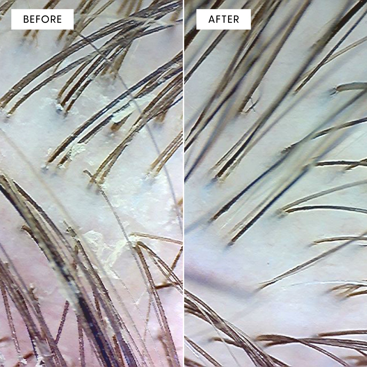 Before and after close-up microscope image of scalp and hair strands using Arey Scalp Scrub. Left labeled BEFORE shows buildup and flaking. Right labeled AFTER shows cleaner, healthier-looking scalp.