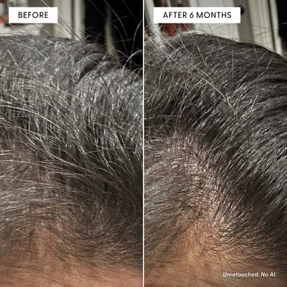 Split image showing a close-up of a scalp before (left) and after 6 months (right), with visible improvement in hair density. The transformation highlights the benefits of consistent in-shower care using Arey’s The Shower Duo Refill. Text notes Unretouched. No AI. in the bottom right corner.