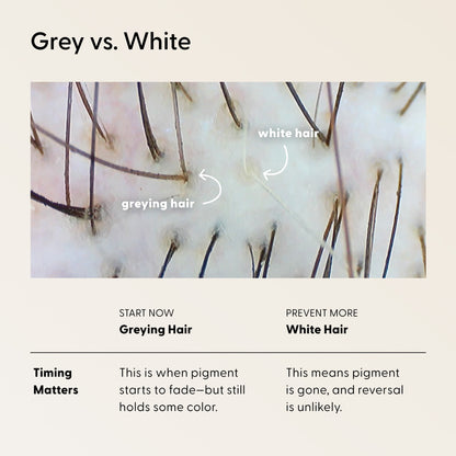 Close-up of scalp showing gray and white hairs. Diagram labels each hair type. Below, a chart explains that greying hair can fade and may be reversible, while white hair means lost pigment and reversal is unlikely. Incorporating The Shower Duo by Arey—an in-shower hair care system designed to cleanse and restore—may support healthier hair as you address changes in pigment.