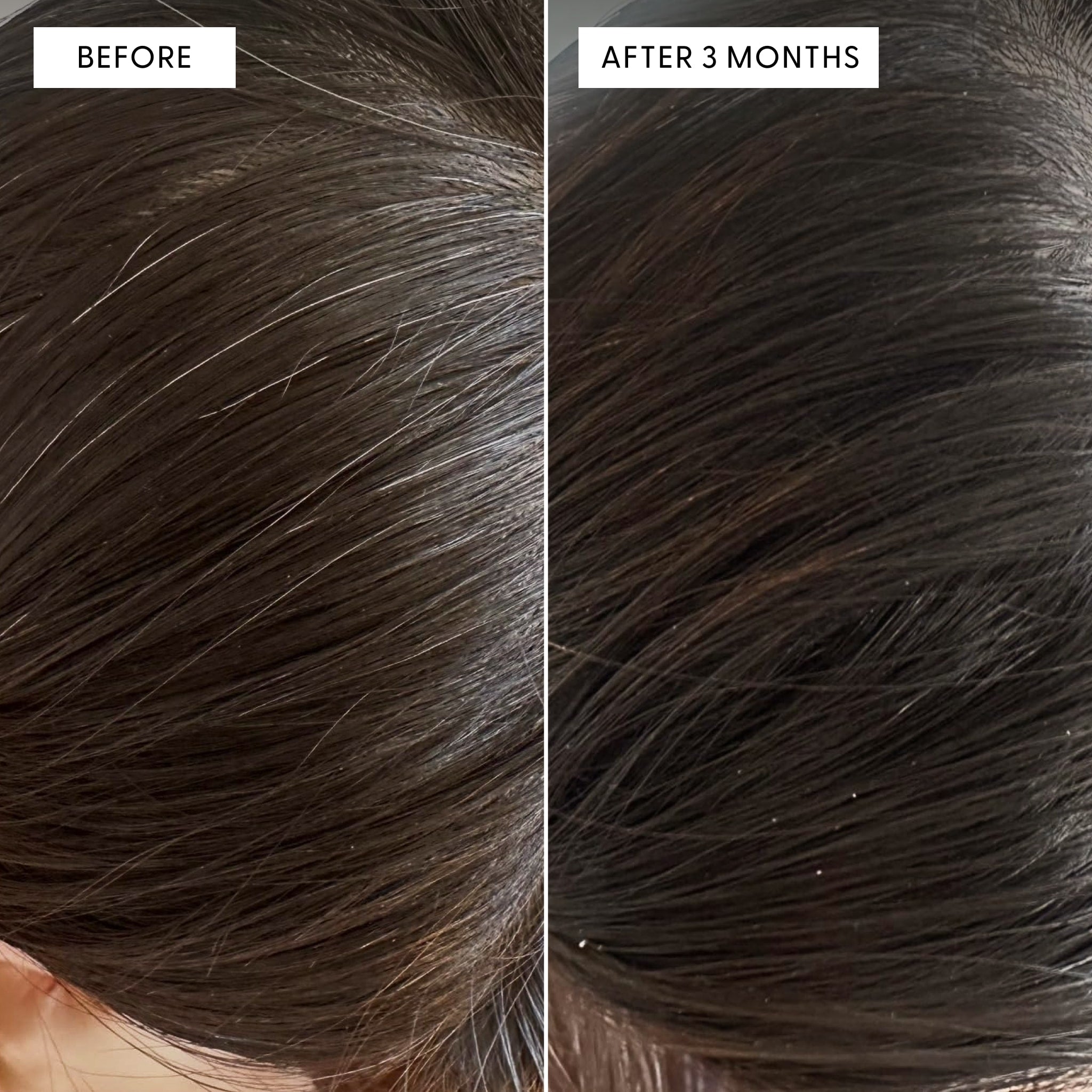 Before and after close-up of a person's scalp showing reduction in grey hairs. Text reads: BEFORE and AFTER 3 MONTHS. The right side shows visibly darker, less grey hair compared to the before.