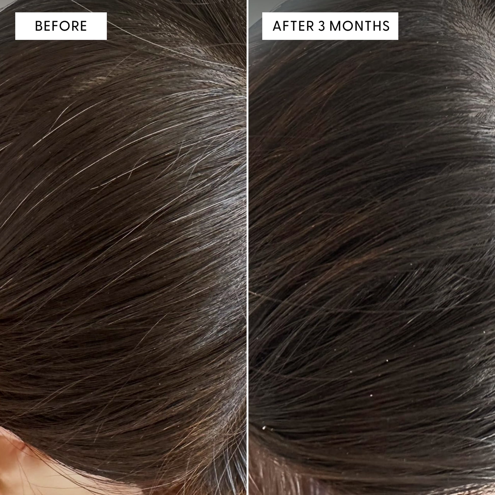 Before and after close-up of a person's scalp showing reduction in grey hairs. Text reads: BEFORE and AFTER 3 MONTHS. The right side shows visibly darker, less grey hair compared to the before.