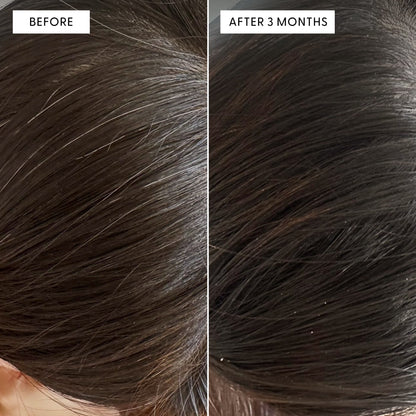Before and after close-up of a person's scalp showing reduction in grey hairs. Text reads: BEFORE and AFTER 3 MONTHS. The right side shows visibly darker, less grey hair compared to the before.