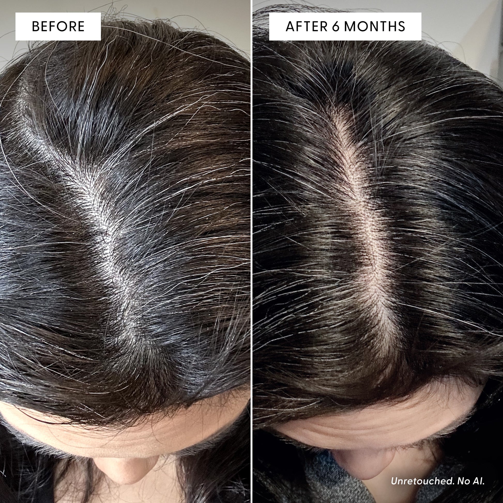 Side-by-side images of a woman’s scalp, showing more gray in the before photo and visibly less gray after 6 months, highlight how aging hair can change. Text reads, Unretouched. No AI. See the visible difference after using Arey To The Root® Scalp Serum, formulated to gradually repigment grey hair over time.