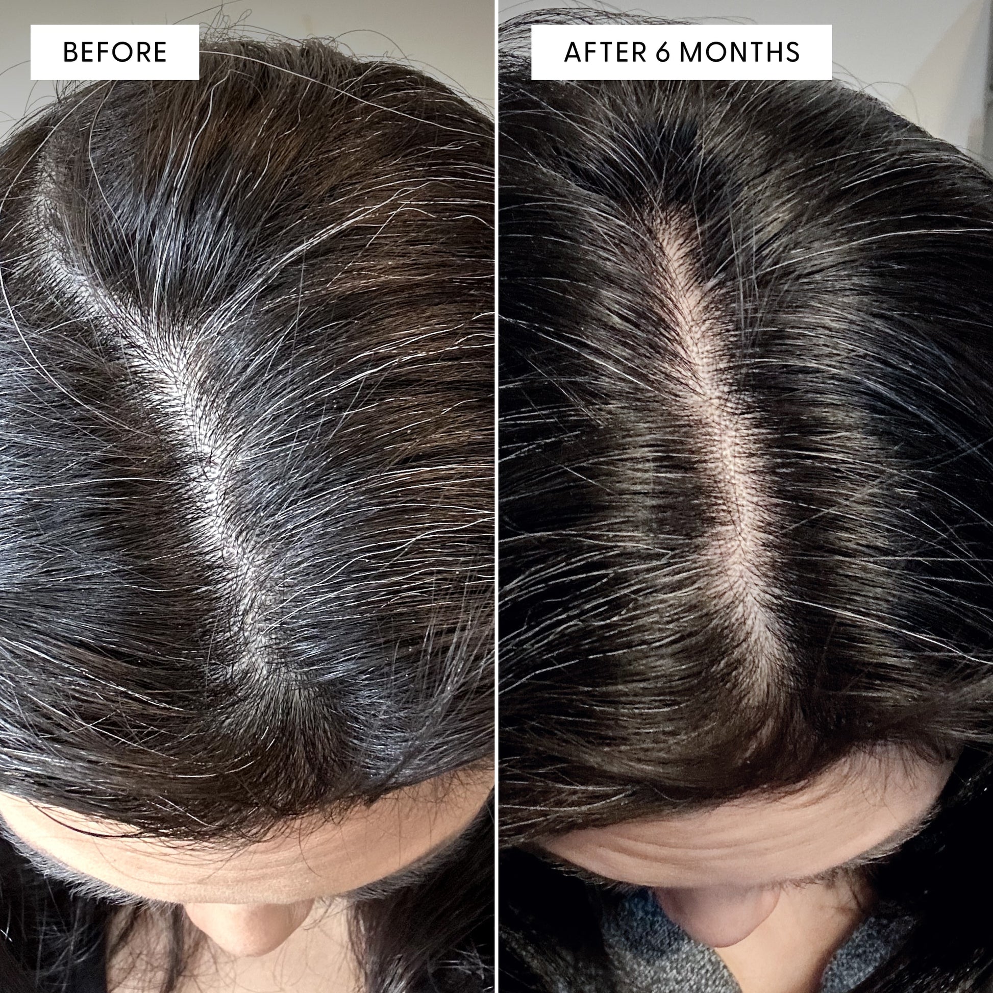 Before and after overhead view of a person's scalp at the part line, showing significant reduction in grey hairs after 6 months. Text reads: BEFORE and AFTER 6 MONTHS.