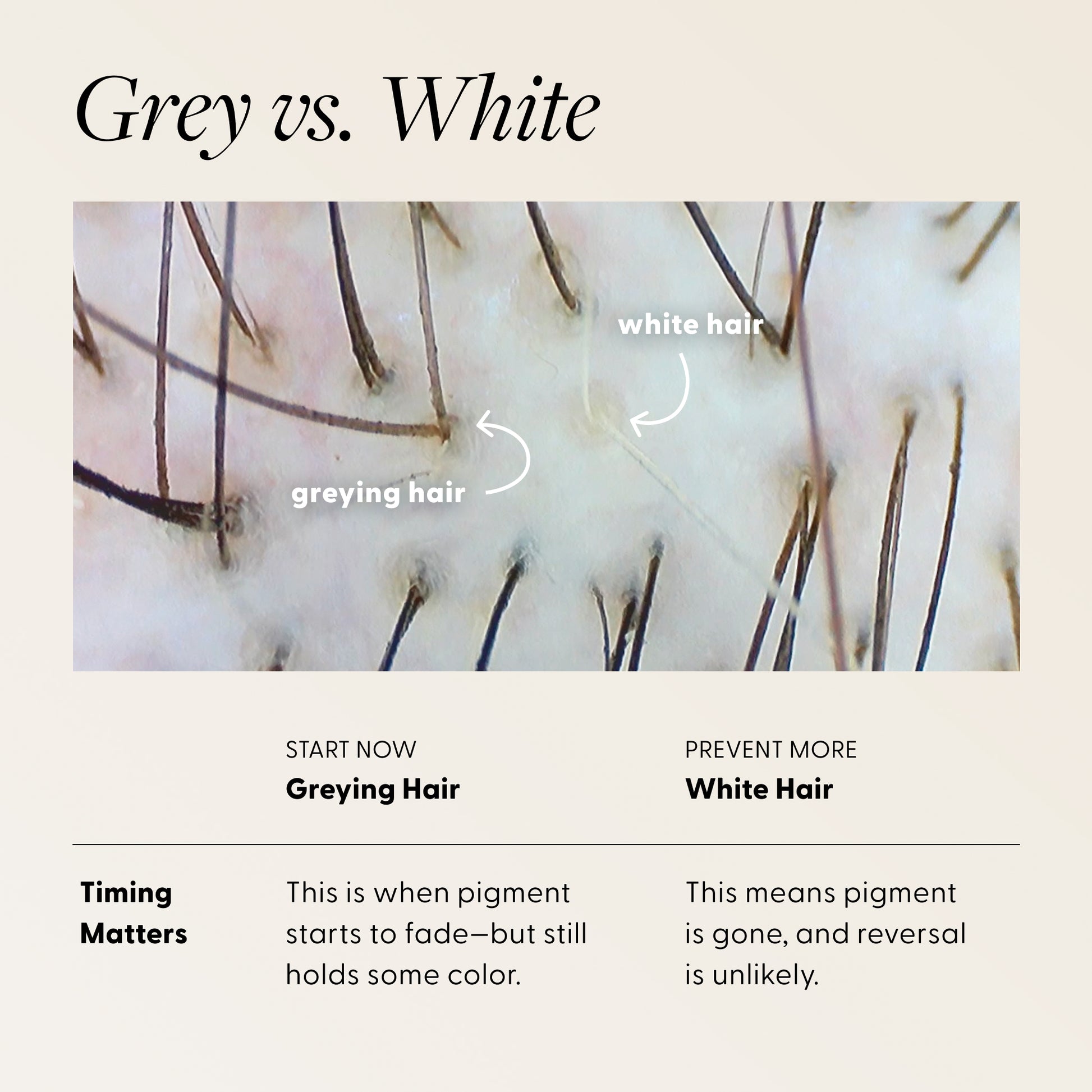 Grey vs. White infographic with close-up microscope image of hair strands labeled 'greying hair' and 'white hair.' Comparison table: Timing Matters — Start Now: Greying Hair (pigment starts to fade but still holds some color); Prevent More: White Hair (pigment is gone and reversal is unlikely).