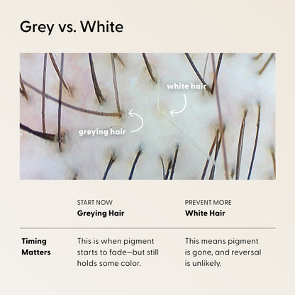 Close-up of scalp displaying both grey and white hairs. Grey hair still contains some pigment, while white hair has lost all pigment. Text describes when greying and white hairs may appear, as well as prevention options such as The Restorative Kit from Arey—formulated to slow the growth of grey hairs and support repigmentation for healthier, more vibrant strands.
