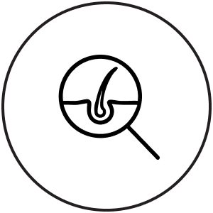 A simple black and white line drawing of a magnifying glass focusing on a hair follicle, enclosed in a circle, symbolizing scalp or hair examination.
