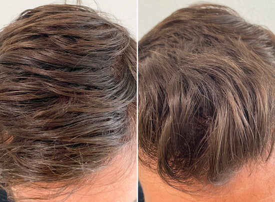 before and after using wash
