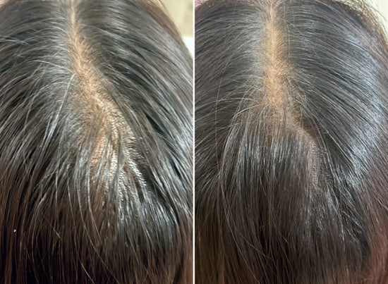 Before and after image. 