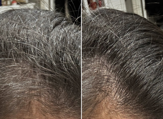 before and after shot from Kim T