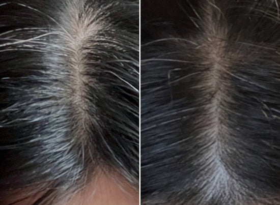 before and after using the duo