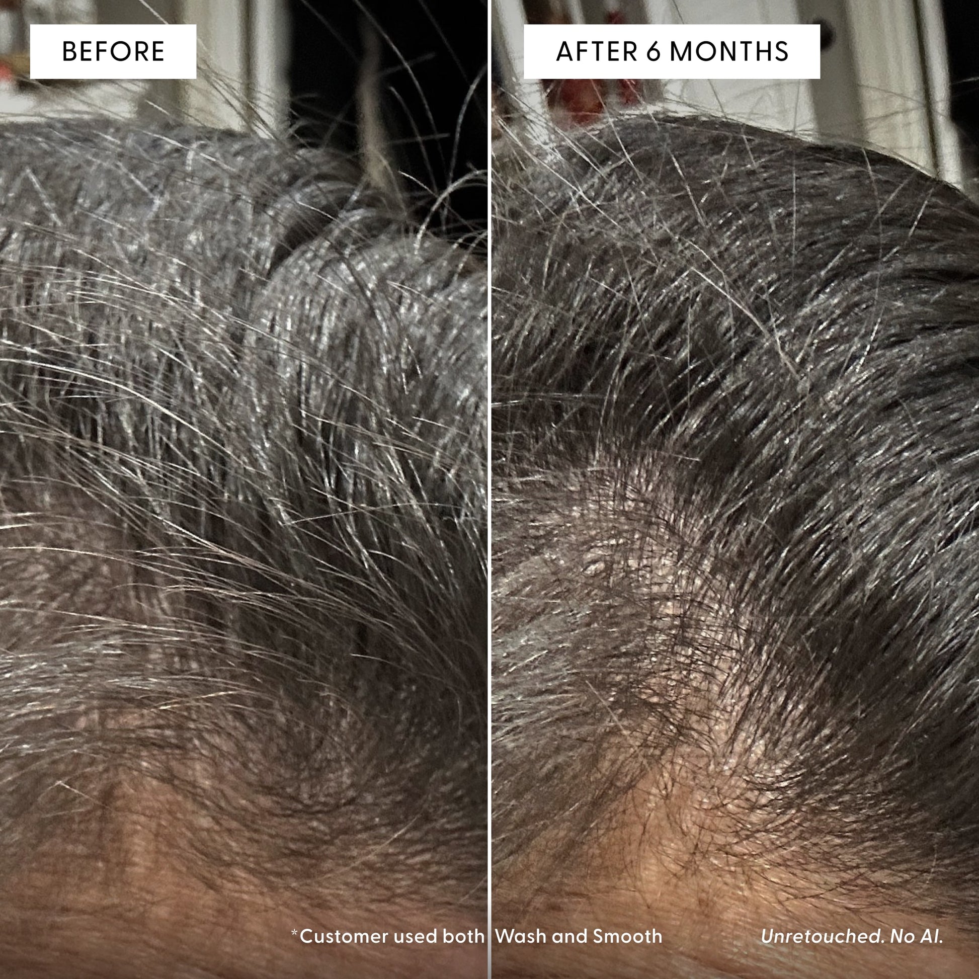 Close-up of a person’s scalp showing two sections: the left labeled Before with thinner hair, and the right labeled After 6 Months with visibly thicker hair. Text notes the customer used Arey Wash Shampoo along with another anti-aging shampoo, and the photo is unretouched.