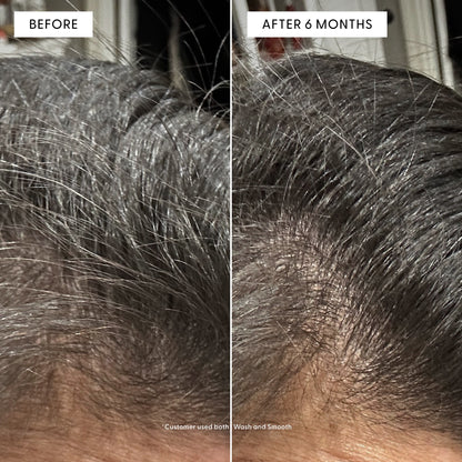 Before and after close-up of a customer's scalp showing hair regrowth. Text reads: "BEFORE" and "AFTER 6 MONTHS". Footnote: *Customer used both Wash and Smooth.