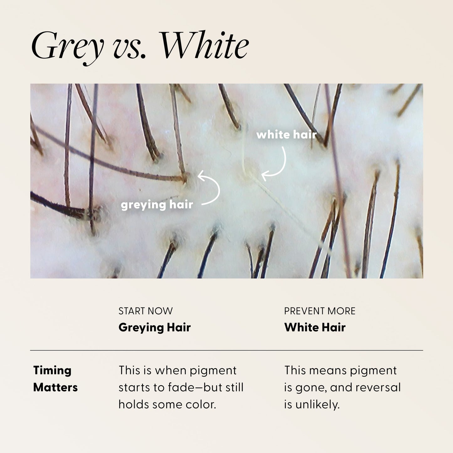 Educational infographic explaining the difference between grey and white hair, with a close-up microscope image of hair strands labeled "greying hair" and "white hair". Text reads: "Grey vs. White" — Start Now: Greying Hair — Timing Matters: This is when pigment starts to fade—but still holds some color. | Prevent More: White Hair — This means pigment is gone, and reversal is unlikely.