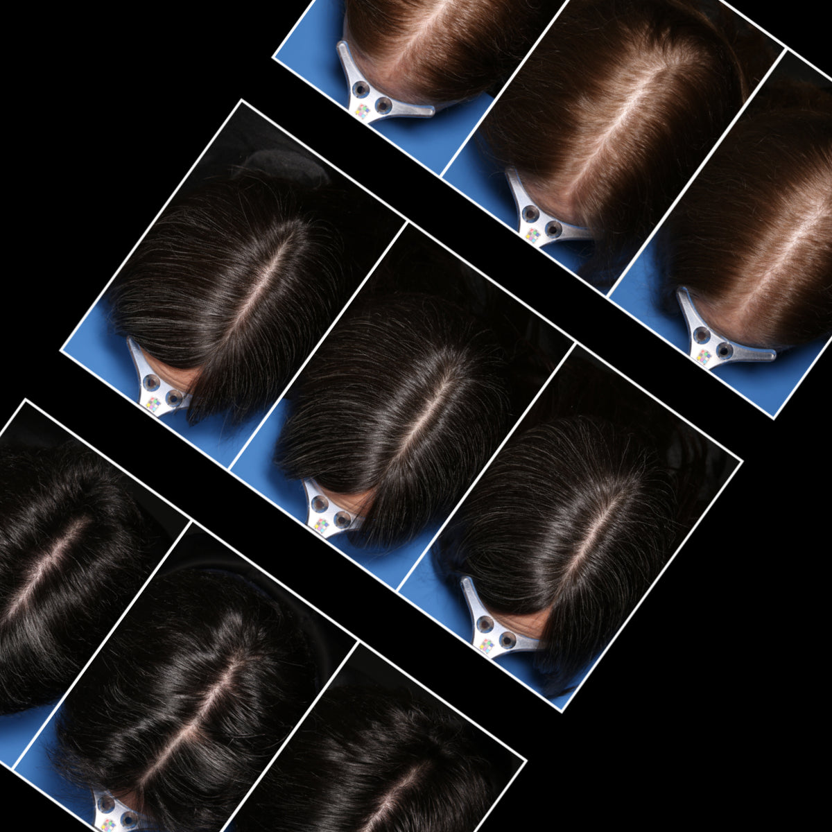 Clinical study photos of participants' hair parts, with one area magnified.