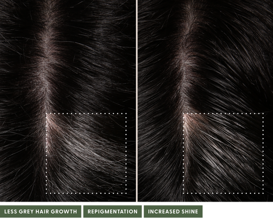 Before and after using The System. After using the system, noticeably less grey hair growth, repigmentation, increased shine