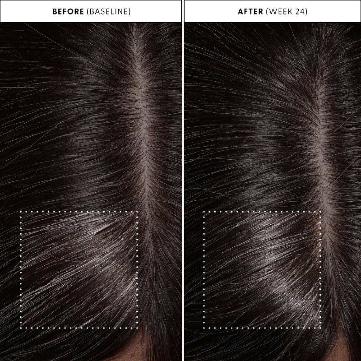 Before and after clinical results: baseline vs week 24